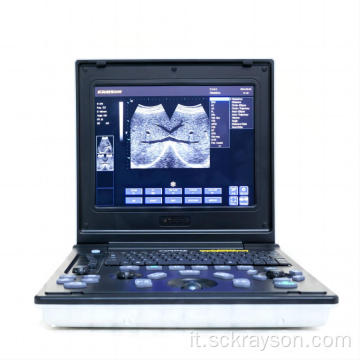 Apparecchiatura diagnostica ad ultrasuoni cuori gradiente d&#39;oro